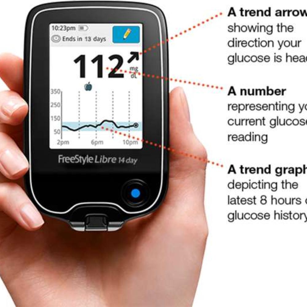 Libre CGM