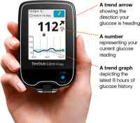 Libre CGM